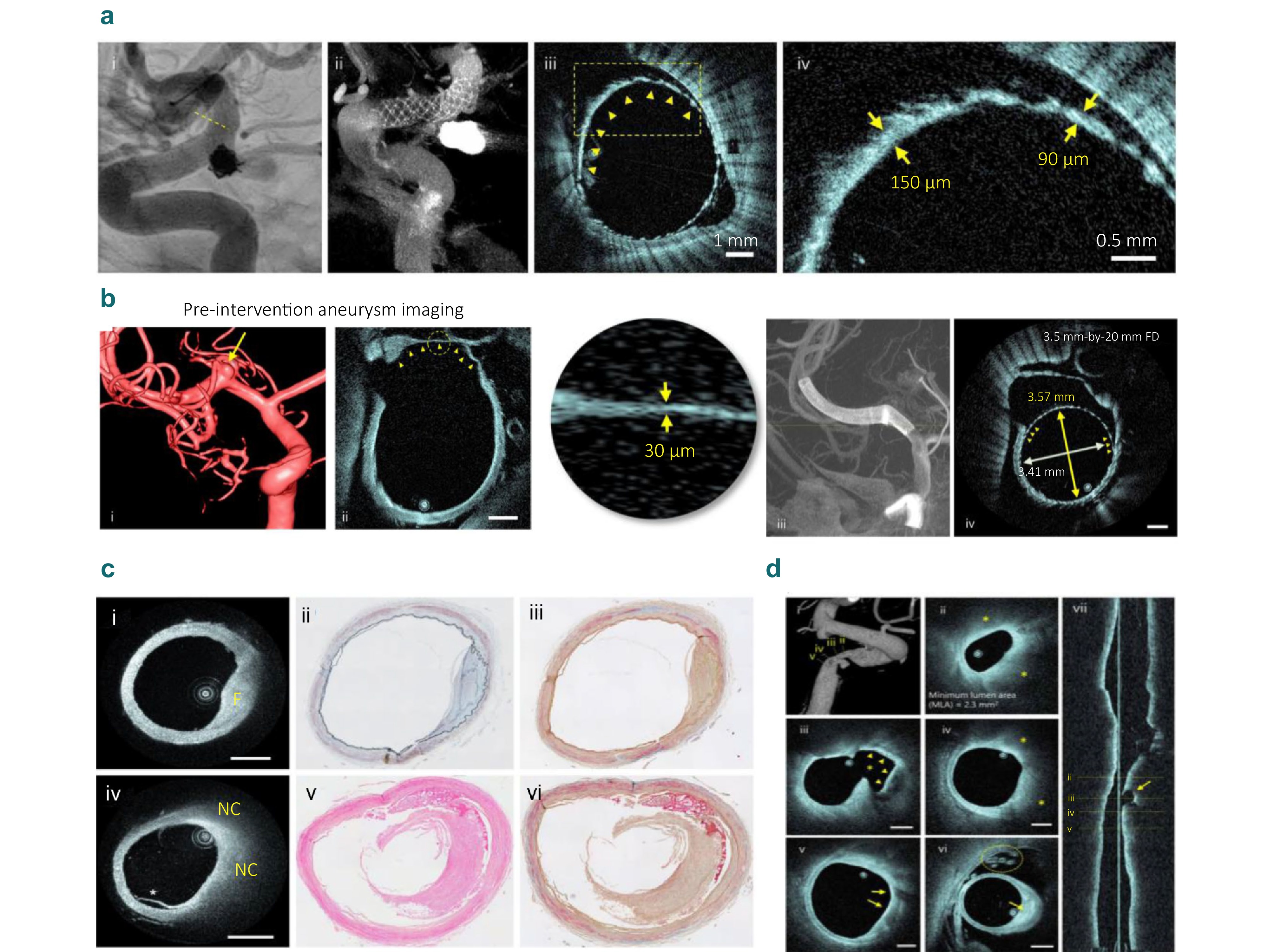 確認用2 Advances in optical coherence tomography for intelligent diagnosis