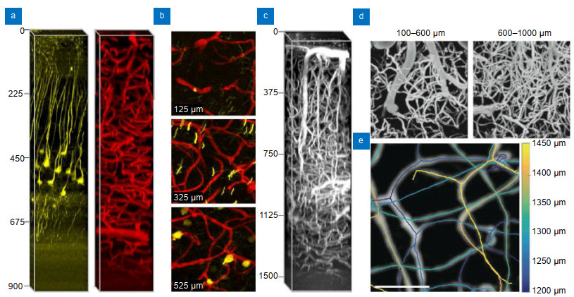 Recent advances in nonlinear optics for bio-imaging applications