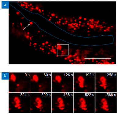 Recent advances in nonlinear optics for bio-imaging applications